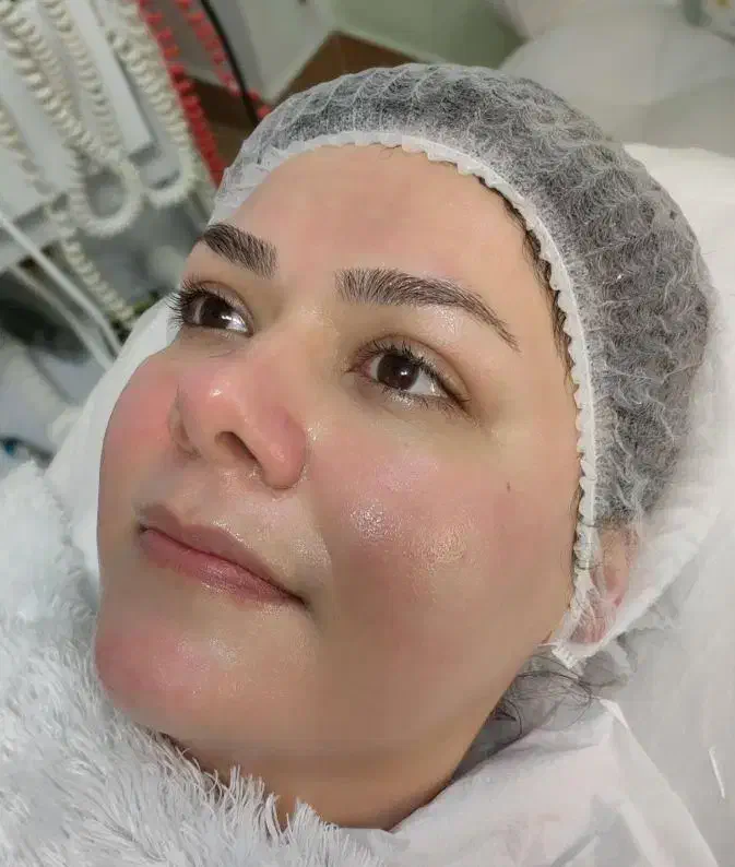 فیشیال صورت آقایان و خانم ها مطب دکترپروین گودرزی|خدمات آرایشگری و زیبایی|یاسوج, |دیوار