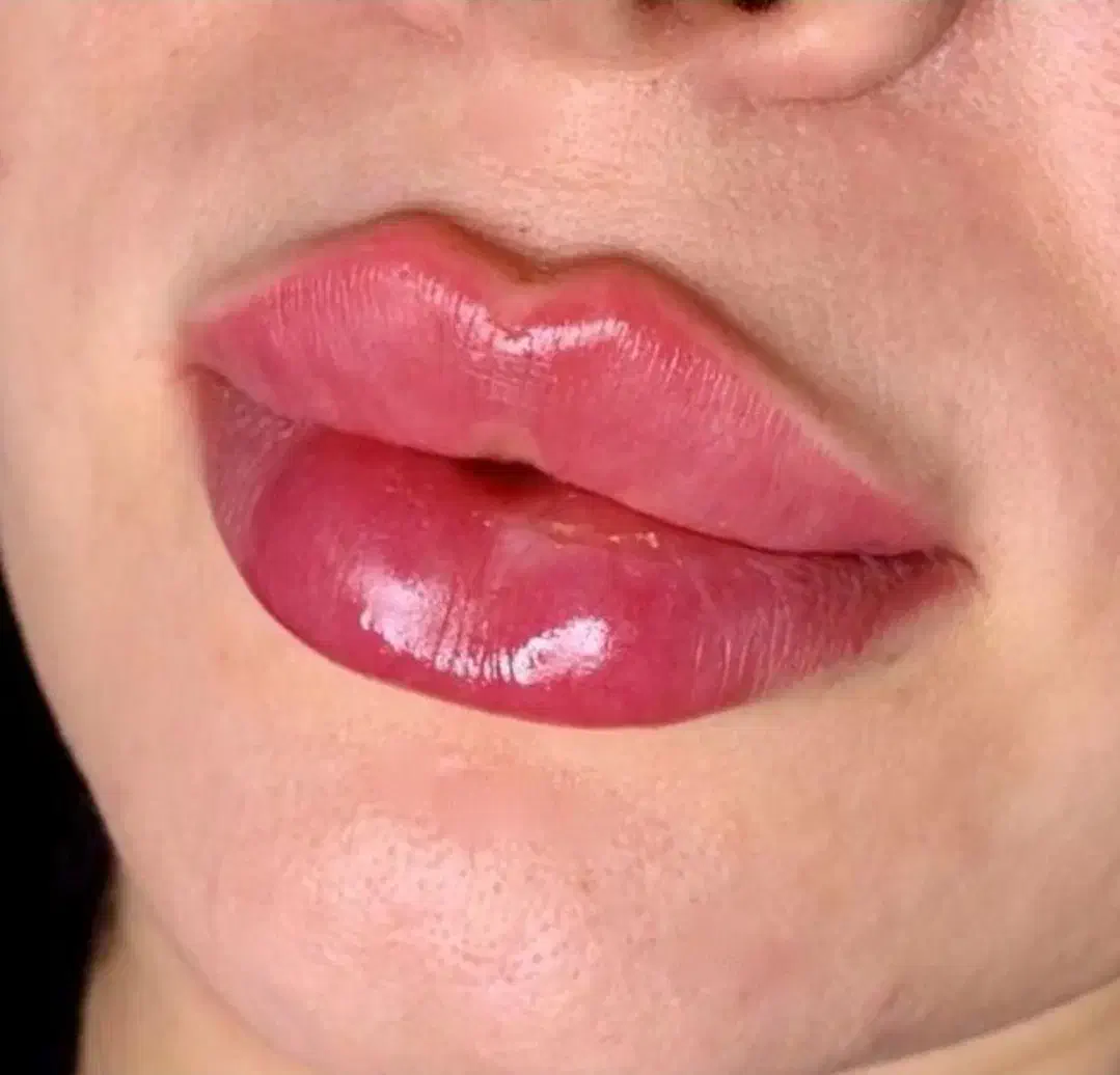 پزشک مزو ژل بوتاکس لب گونه چشم چانه زاویه فیلر prp|خدمات آرایشگری و زیبایی|کرج, گوهردشت|دیوار