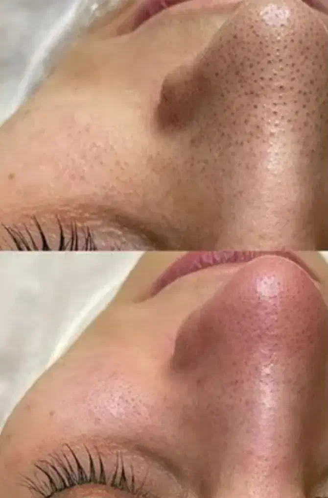 تخفیف ویژه|خدمات آرایشگری و زیبایی|کاشان, ولیعصر|دیوار