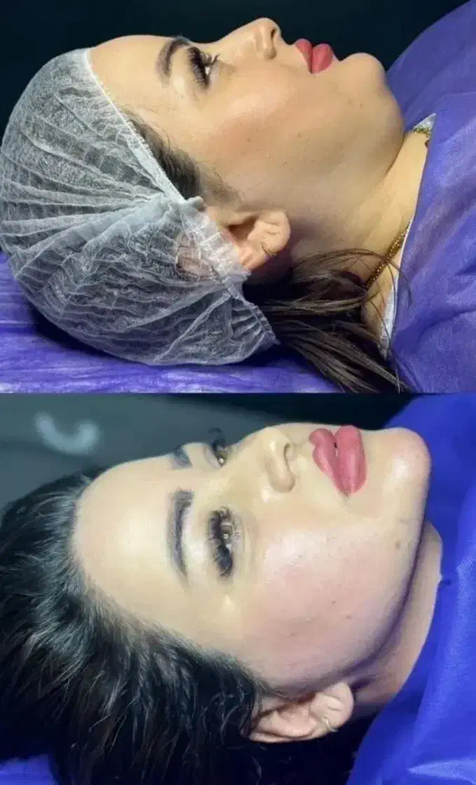 مرکزلیپوساکشن و ساکشن غبغب و زاویه سازی توسط جراح|خدمات آرایشگری و زیبایی|مشهد, سناباد|دیوار