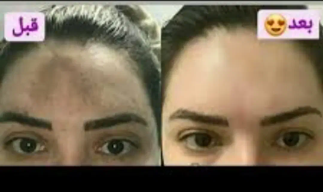 کرم معجزه شب|آرایشی، بهداشتی، درمانی|اردبیل, |دیوار