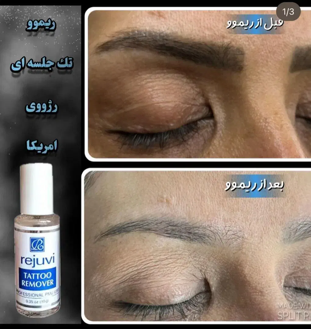 پاک کردن تتو ابرو و لب و چشم|خدمات آرایشگری و زیبایی|شاهینشهر, خبرنگار|دیوار
