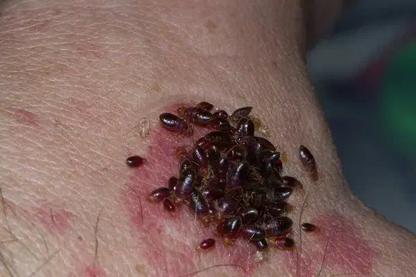 سَمپاشی،سم پاشی ساس منزل حجره ادارات ارگانها پاساژ|خدمات نظافت|کرمان, |دیوار