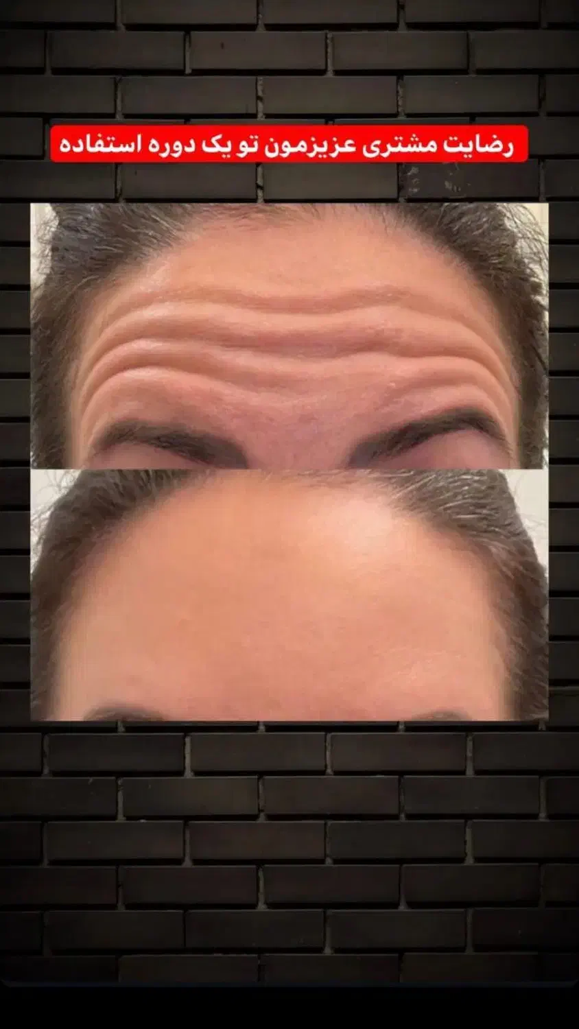 کرم رفع چین و چروک صورت|آرایشی، بهداشتی، درمانی|تبریز, |دیوار