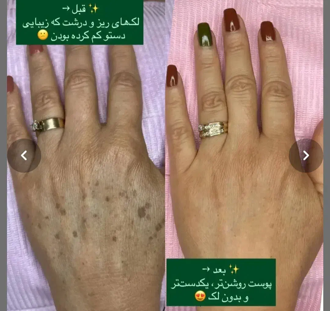 فیشیال و آلگاپیل و خالبرداری و هایفرکوئنسی|خدمات آرایشگری و زیبایی|شیراز, شریف‌آباد|دیوار