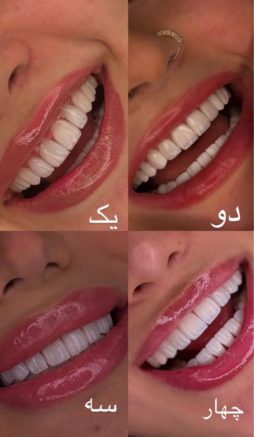 استخدام منشی دندانپزشکی و دستیار (حتی کار اموز)|استخدام درمانی، زیبایی، بهداشتی|تهران, دردشت|دیوار