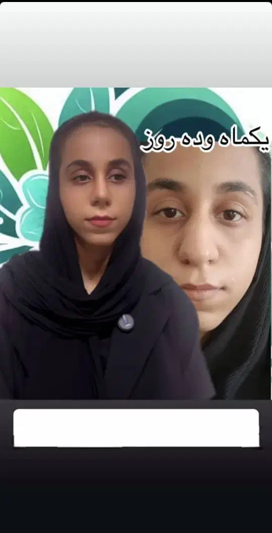 عمل زیبایی بینی در مازندران|خدمات آرایشگری و زیبایی|قائمشهر, |دیوار