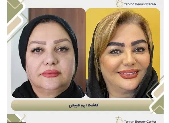 تور جراحی و خدمات زیبایی زیبایی|خدمات آرایشگری و زیبایی|کرمان, |دیوار