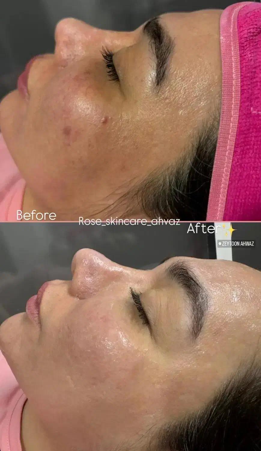 فیشیال|خدمات آرایشگری و زیبایی|اهواز, زیتون کارمندی|دیوار