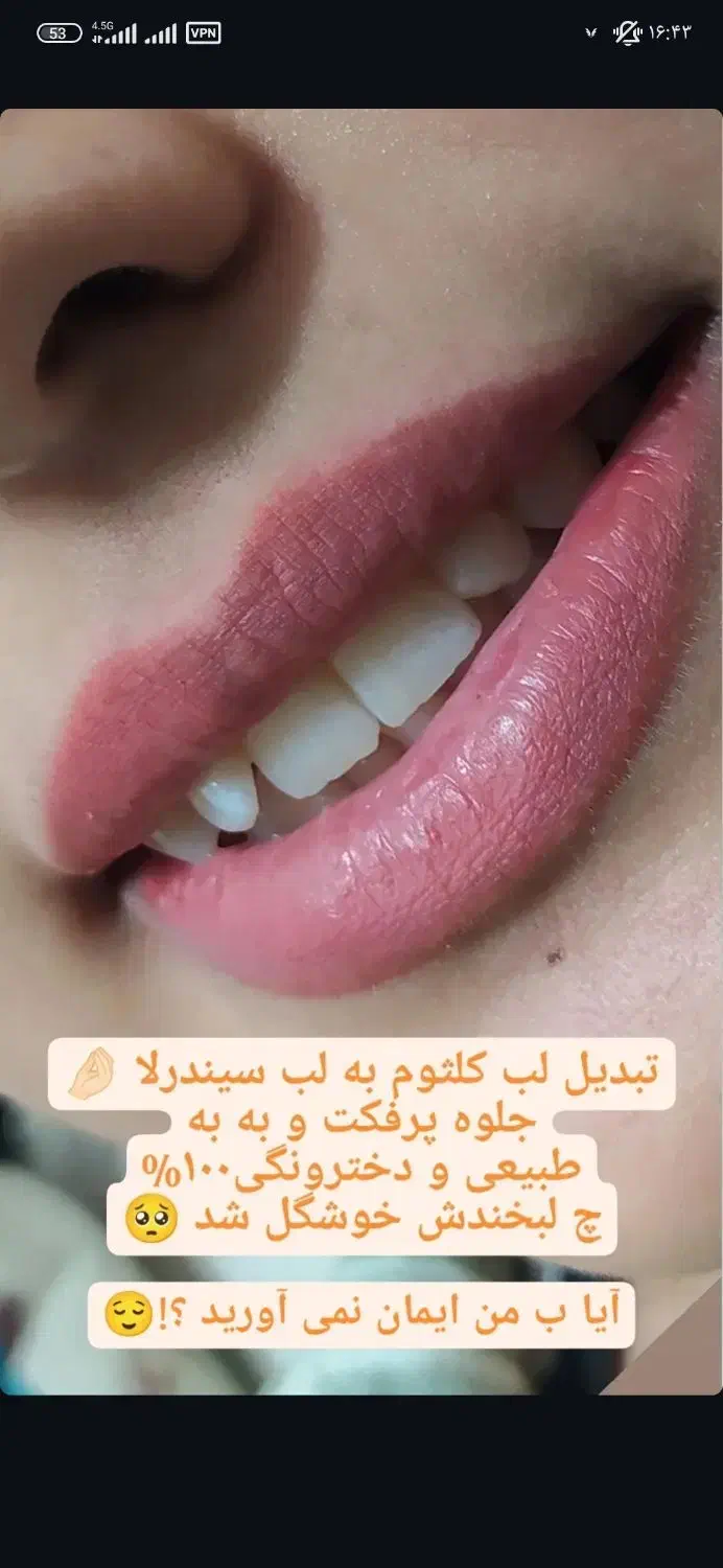 تخفیف یلدایی تتو بدن آرایش دائم ریموو و اموزش ها|خدمات آرایشگری و زیبایی|اردکان, |دیوار