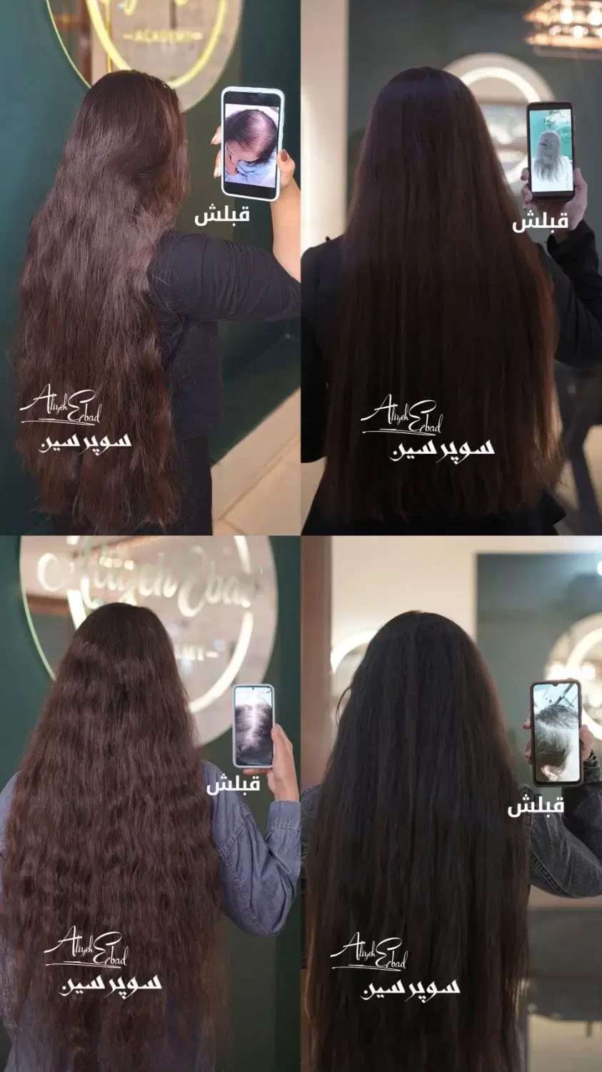 درمان ریزش مو رشد ۴برابری بدون سوزن گارا نتی دار|خدمات زیبایی و سلامت|مشهد, جانباز|دیوار