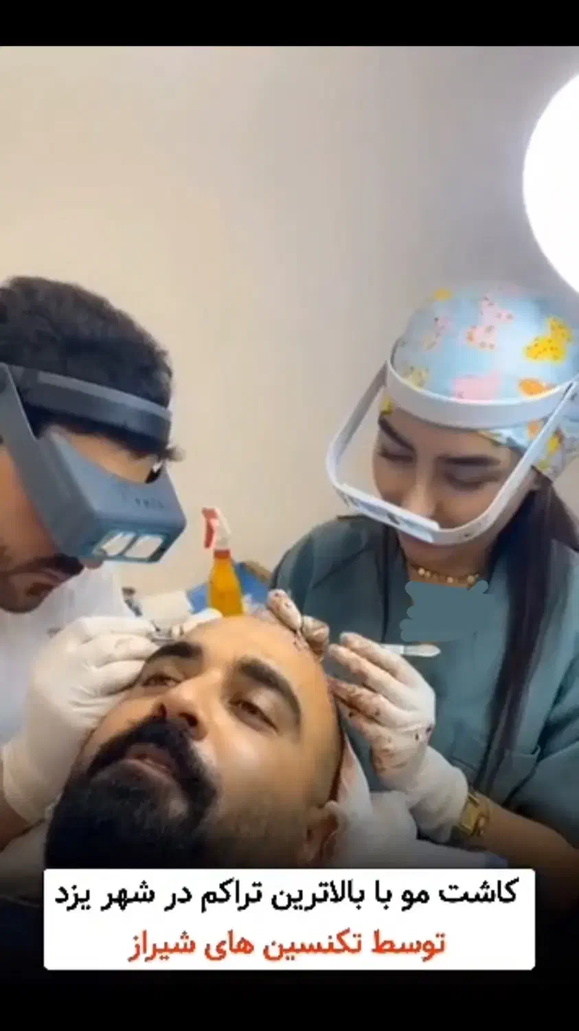 کاشت مو توسط تکنسین شیرازی در یزد|خدمات آرایشگری و زیبایی|یزد, |دیوار