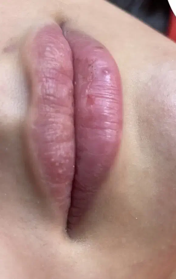 تزریق ژل و بوتاکس با تخفیفات بی نظیر به مدت محدود|خدمات آرایشگری و زیبایی|مشهد, فرهنگ|دیوار