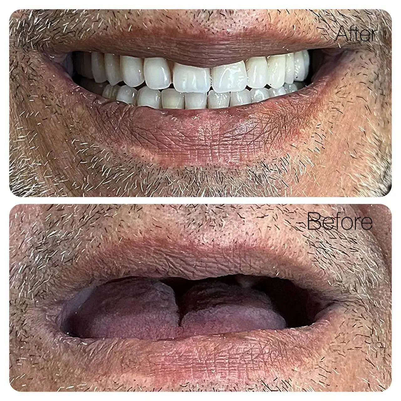 دندان مصنوعی|خدمات آرایشگری و زیبایی|تهران, فلسطین (میدان انقلاب)|دیوار