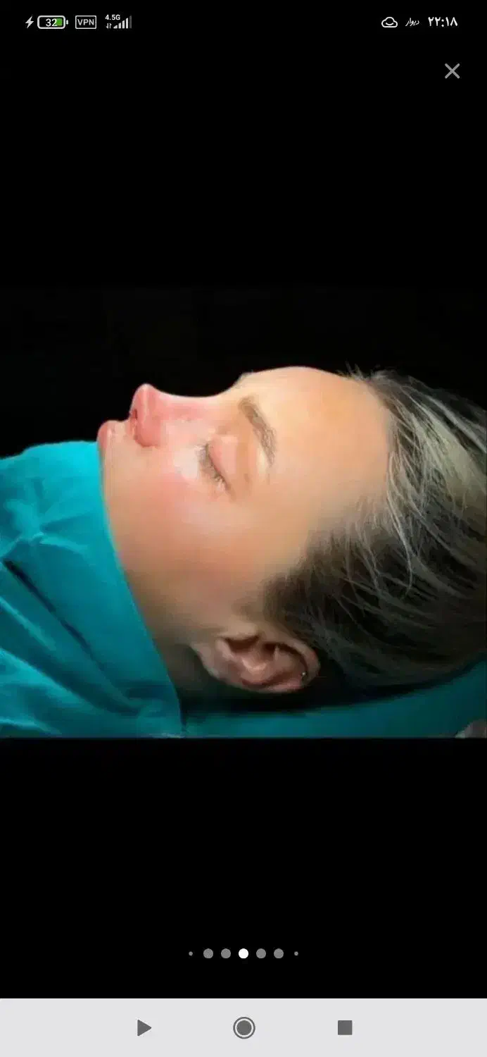 جشنواره لیپو .مامو .بینی بلفارو کل صورت .چک صیادی|خدمات آرایشگری و زیبایی|تهران, دروس|دیوار