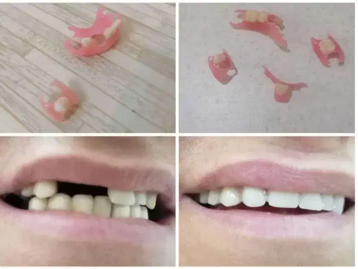 لابراتوار دندانسازی(نیودنت Newdent)|خدمات آرایشگری و زیبایی|کاشمر, |دیوار