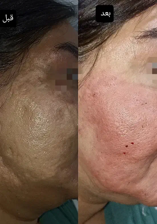 جشنواره ژل و تمامی خدمات پوست و مو|خدمات آرایشگری و زیبایی|شیراز, باغشهر قصر سبز|دیوار