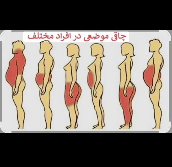 درمان لاغری و چاقی شما|خدمات آموزشی|همدان, |دیوار
