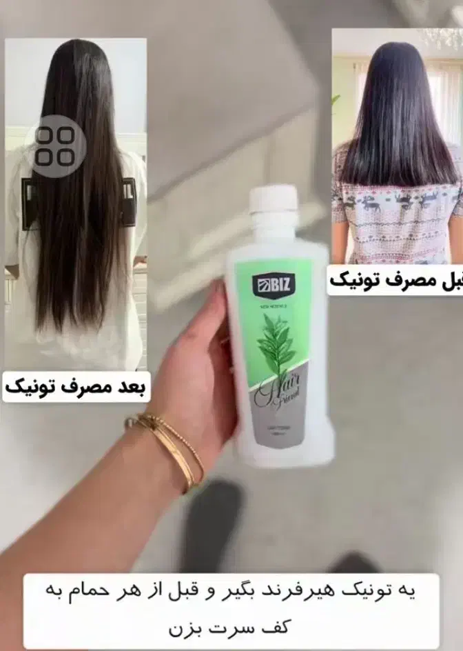 رشد مو|آرایشی، بهداشتی، درمانی|نهبندان, |دیوار