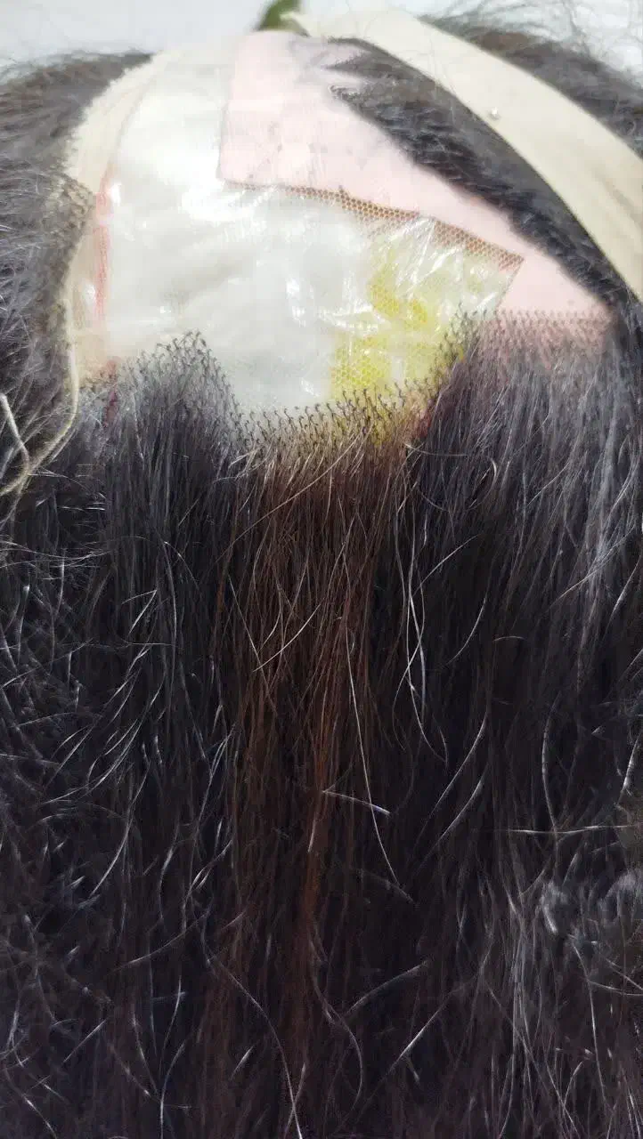 پروتز مو زنانه مردانه|آرایشی، بهداشتی، درمانی|تهران, شهرک ولیعصر جنوبی|دیوار