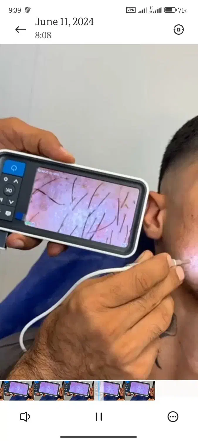 مشاوره داوطلبانه ریزش مو|فعالیت داوطلبانه|تهران, آجودانیه|دیوار