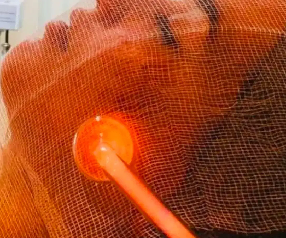 پاکسازی و فیشیال پوست|خدمات آرایشگری و زیبایی|مسجد سلیمان, |دیوار