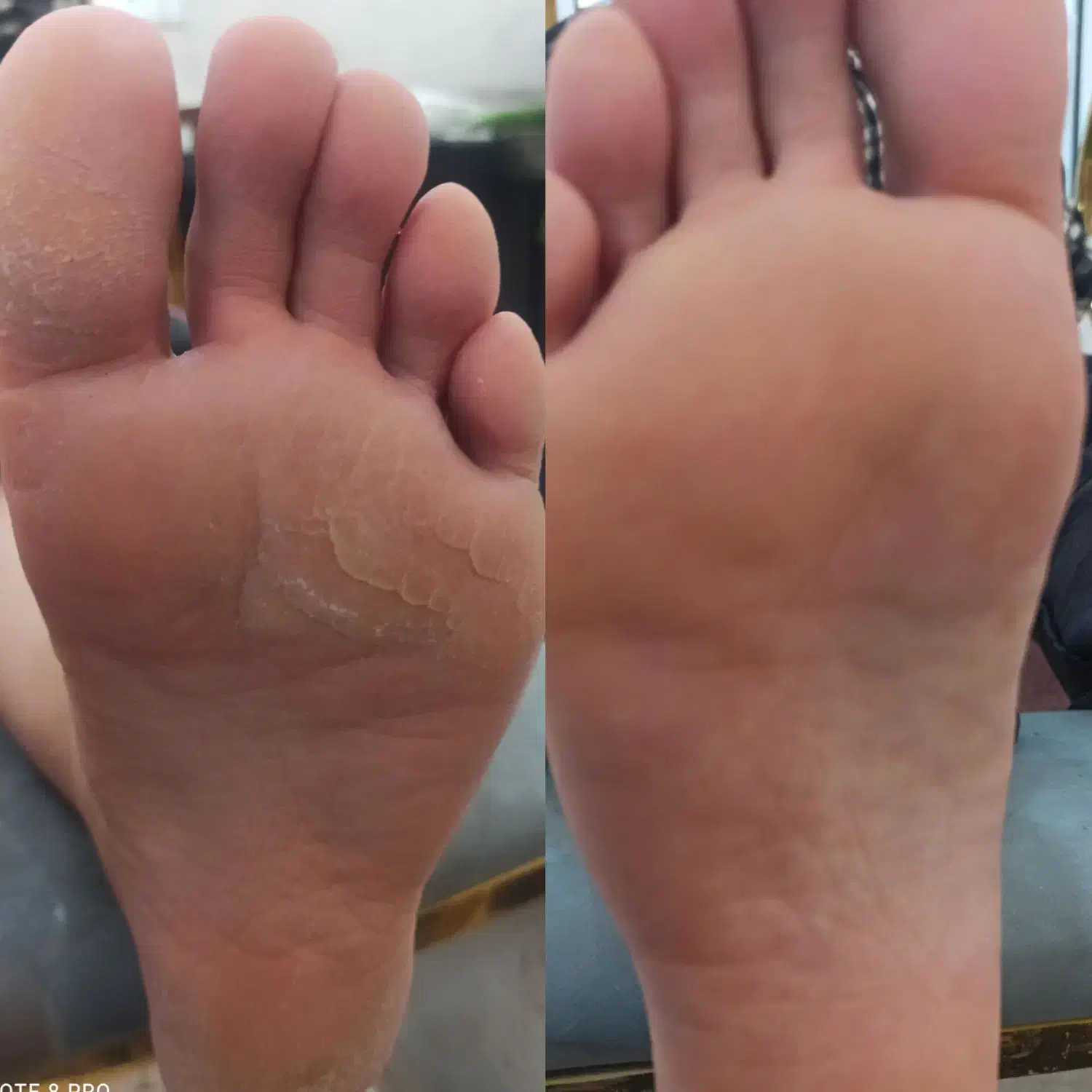 پدیکور پا|خدمات آرایشگری و زیبایی|بروجرد, |دیوار