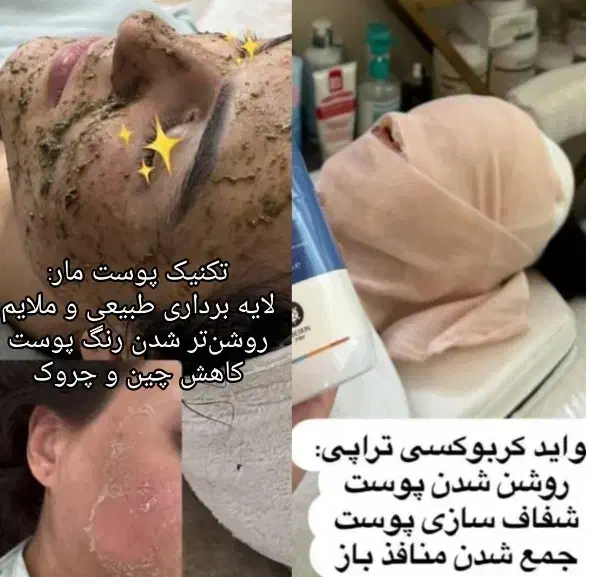 انجام خدمات پوستی هم بانوان و اقایان|خدمات آرایشگری و زیبایی|گرگان, |دیوار