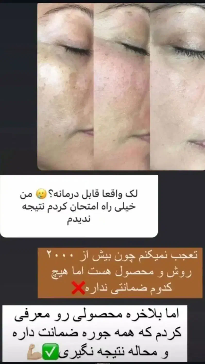 پک صورت گیاهی ضدلک و کک مک|آرایشی، بهداشتی، درمانی|آباده, |دیوار