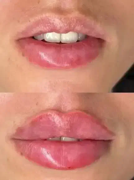 جشنواره ویژه یلدایی ژل،بوتاکس،پرسینگ|خدمات آرایشگری و زیبایی|ملایر, |دیوار