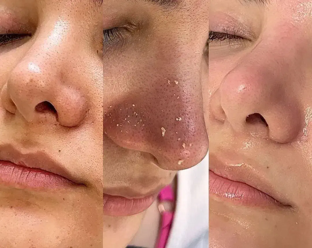 فشیال تخصصی / تخفیف تا شب یلدا|خدمات آرایشگری و زیبایی|مشهد, تلگرد|دیوار