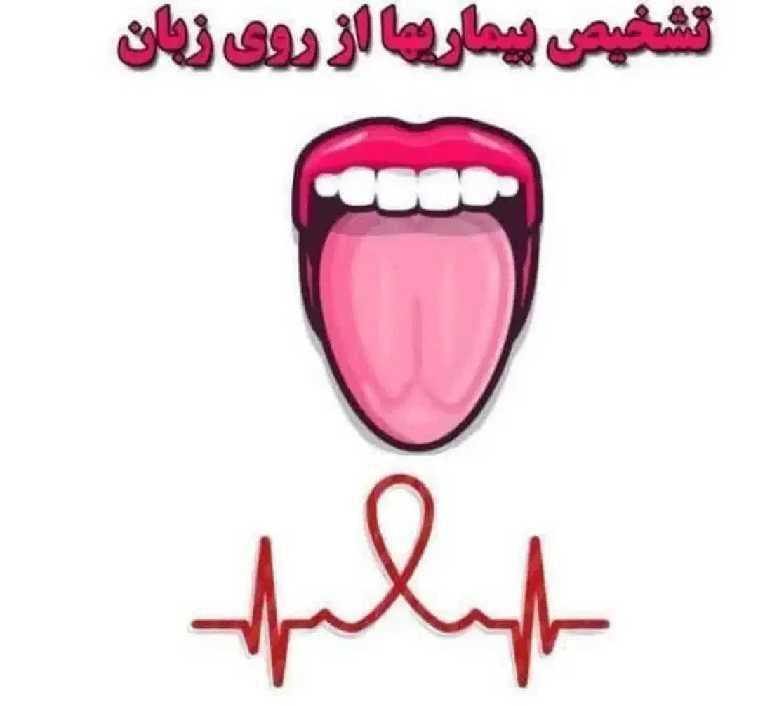 همایش تشخیص بیماری ها از روی زبان|گردهمایی و همایش|تهران, آسمان|دیوار