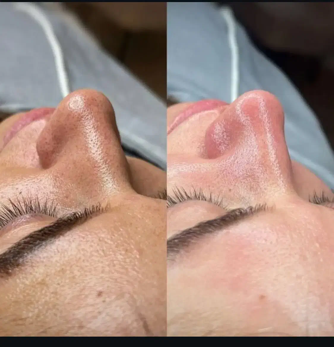 تخفیف به مدت یک هفته(پاکسازی پوست،اپلاسیون،لیفت)|خدمات آرایشگری و زیبایی|گالیکش, |دیوار