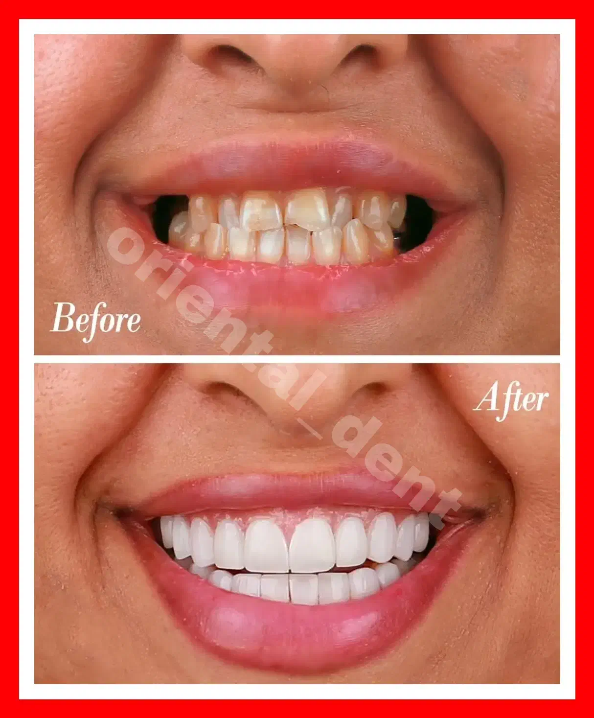 بریج و کامپوزیت و لیفت لثه جرمگیری دندان عصبکشی|خدمات آرایشگری و زیبایی|تهران, تهرانپارس غربی|دیوار
