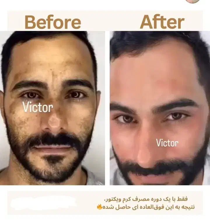 کرم فوقالعاده قوی ویکتور قیمت یک میلیون .|حراج|بروجرد, |دیوار