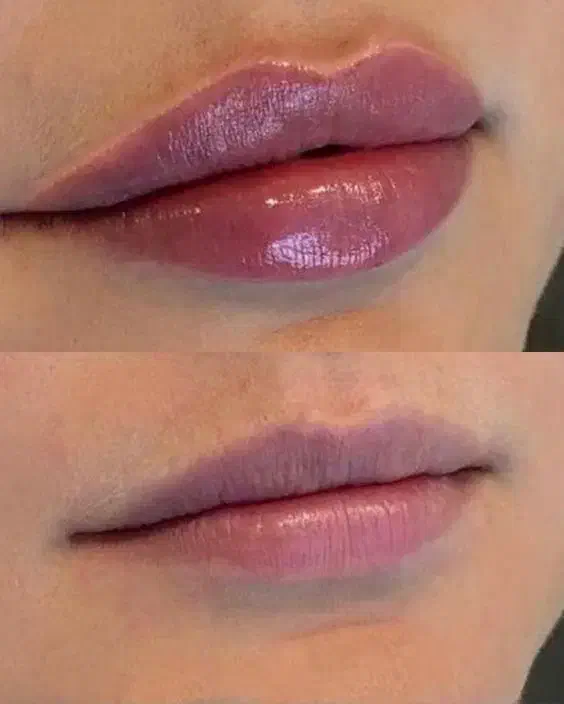 مدل جهت فیلر لیبل دار ،دارای تاییدیه بین المللی|خدمات آرایشگری و زیبایی|ری, دولت‌آباد|دیوار