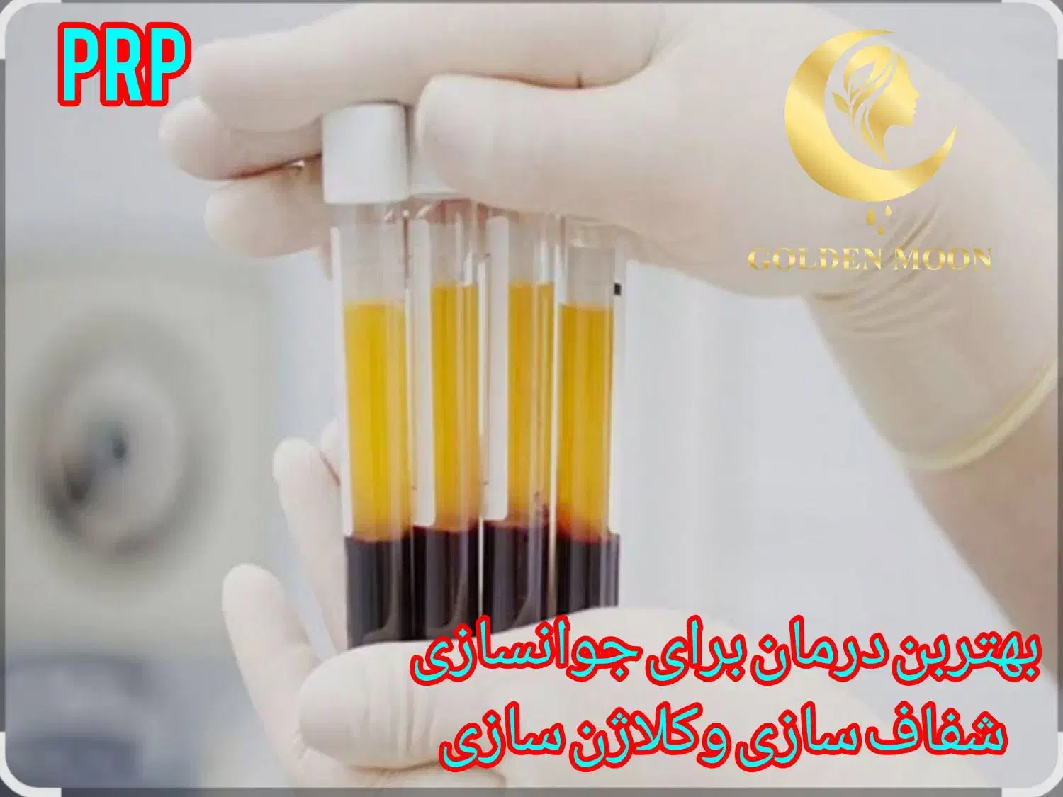 خدمات پاکسازی پوست،میکرونیدیلینگ، پلکسرواسیدتراپی|خدمات آرایشگری و زیبایی|کرج, گوهردشت|دیوار