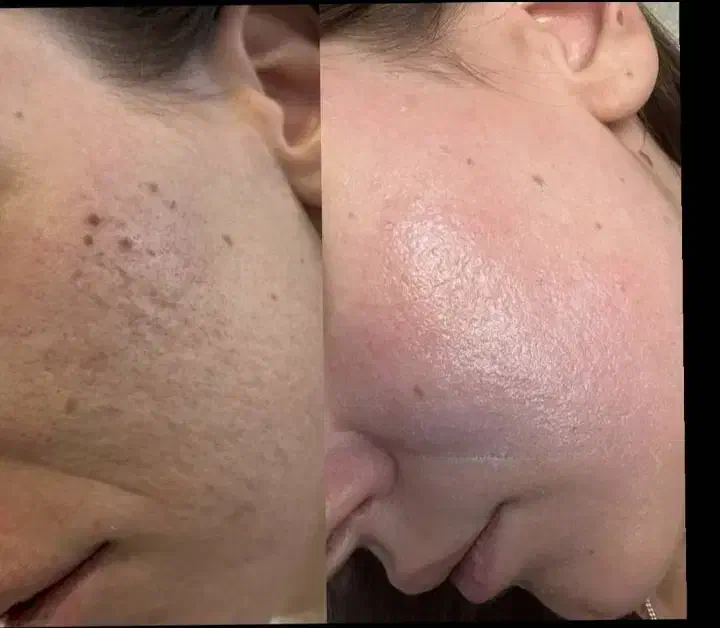 آموزش فیشال مبتدی و پیشرفته|خدمات آموزشی|آبادان, |دیوار