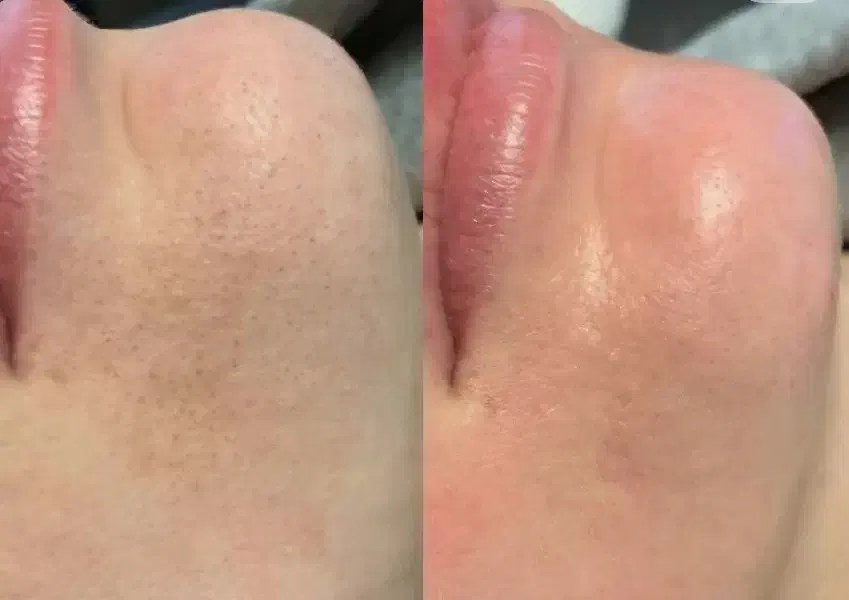 فیشال مدل|خدمات آرایشگری و زیبایی|اصفهان, سرچشمه|دیوار