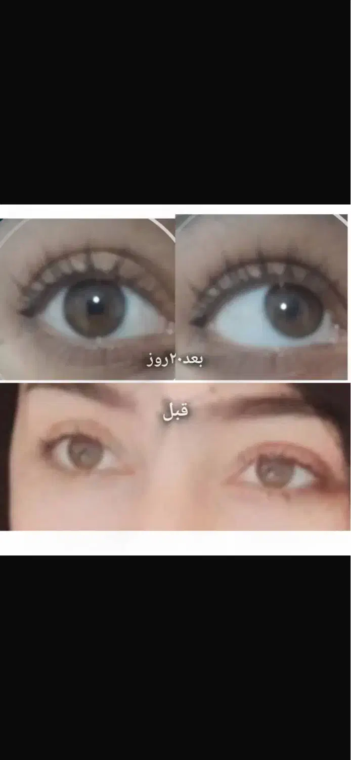 روغن فندق یک وسیله شخصی زیبایی برای هرنفر|آرایشی، بهداشتی، درمانی|رامسر, |دیوار