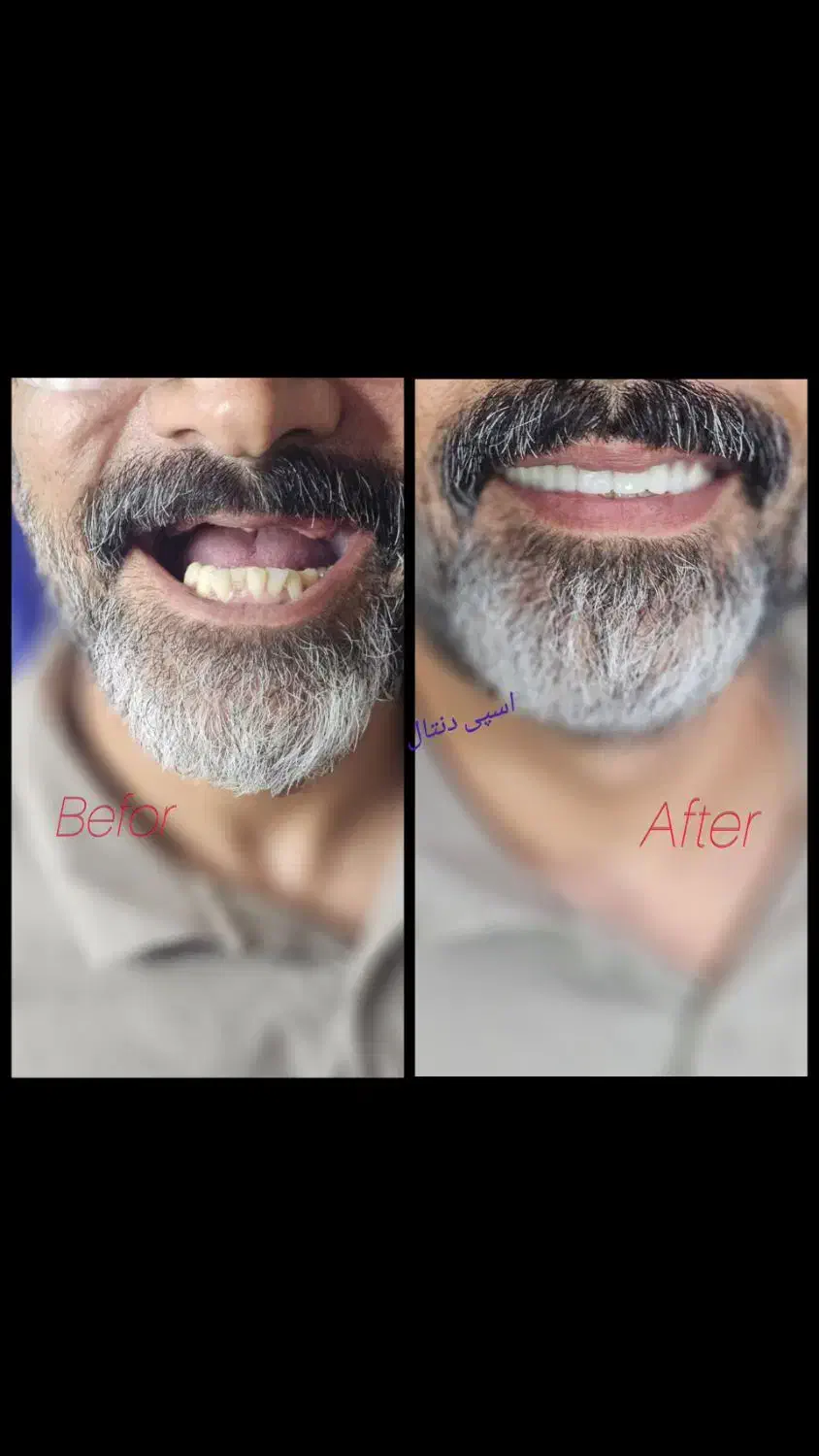 مرکز تخصصی دندانسازی اسپی دنتال|خدمات آرایشگری و زیبایی|خرمآباد, |دیوار