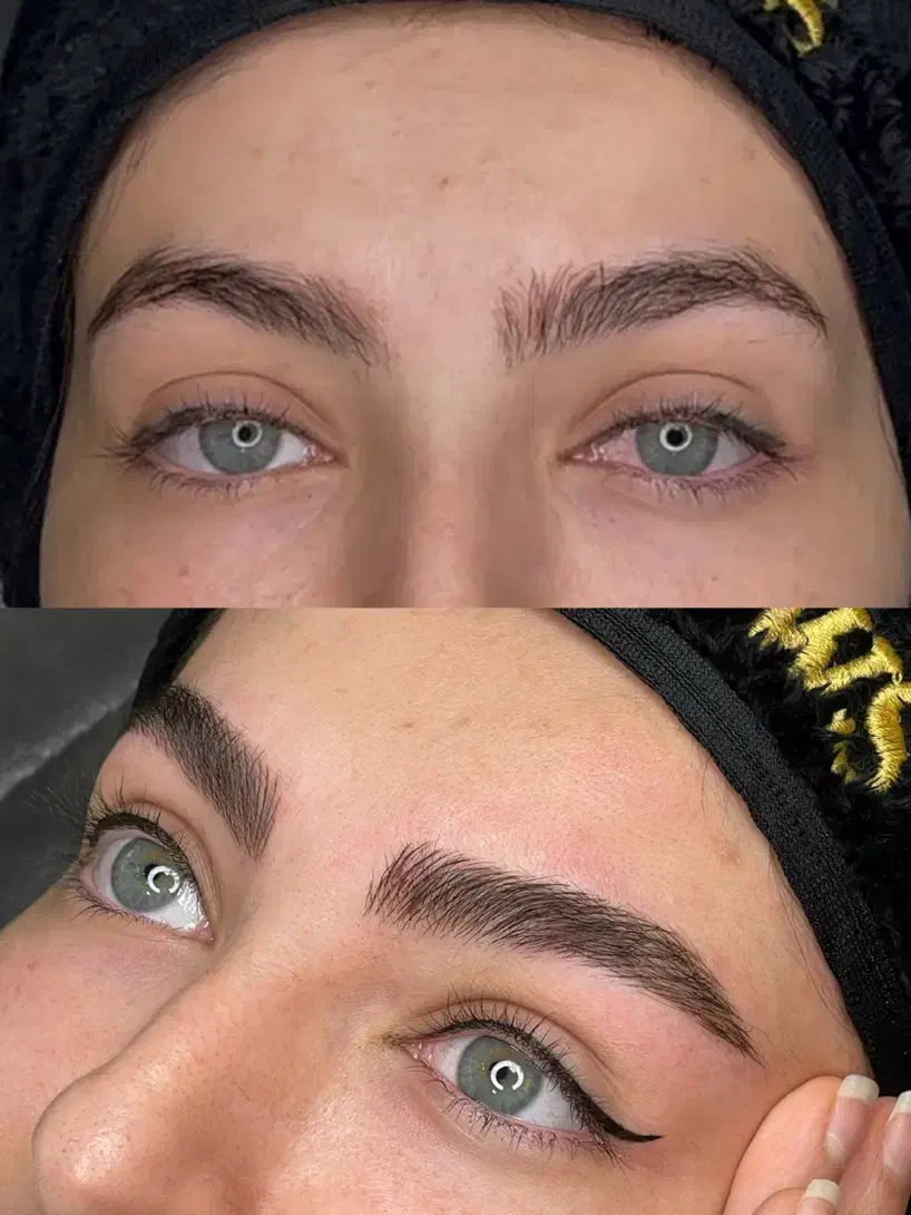 میکروبلیدینگ و شیدینگ|خدمات آرایشگری و زیبایی|تهران, تهرانپارس شرقی|دیوار