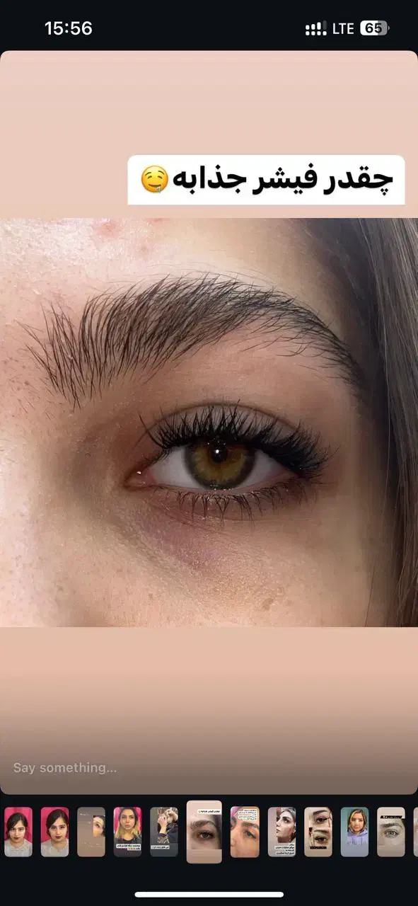 کاشت هیدن فقط 150 تومن|خدمات آرایشگری و زیبایی|رشت, رشتیان|دیوار