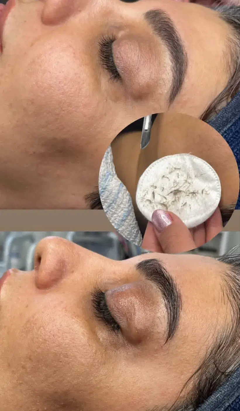 پاکسازی و فیشال صورت|خدمات آرایشگری و زیبایی|سمنان, |دیوار