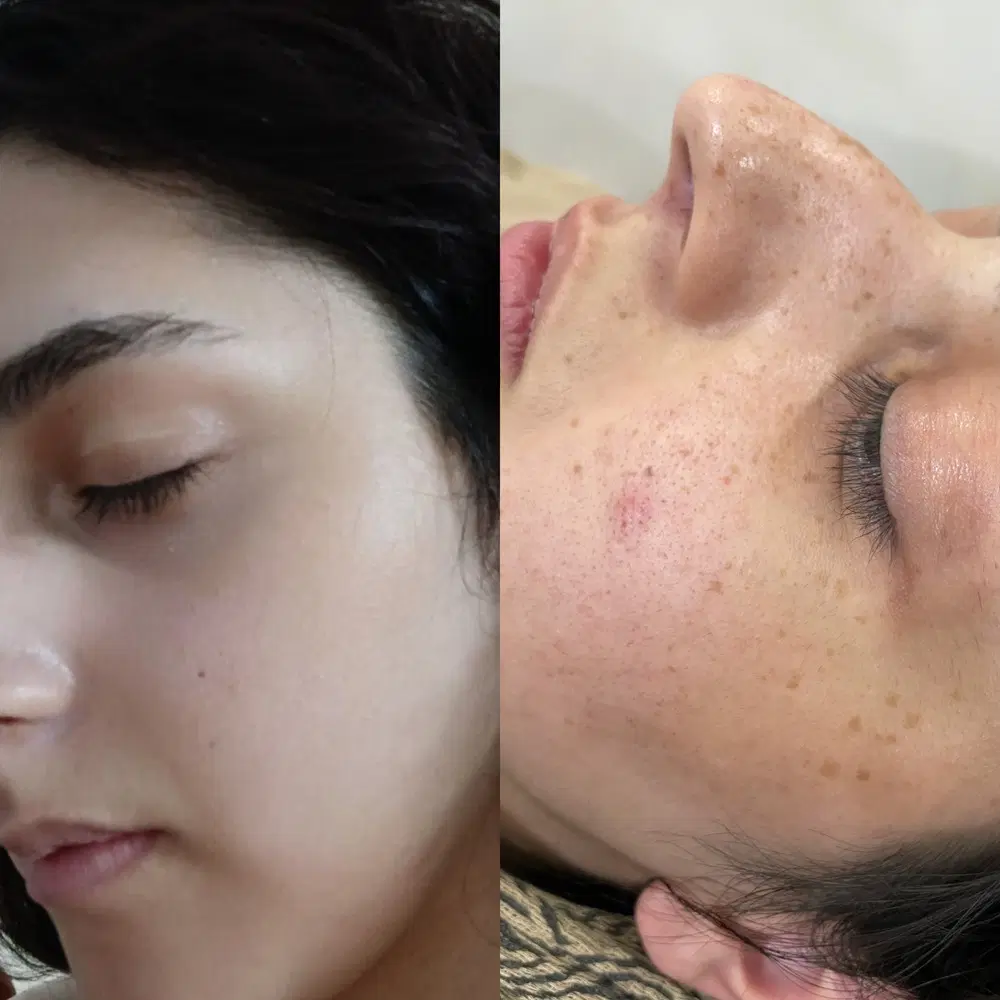 تخصصی ترین حرفه ای ترین مرکزدرمان انواع لک وکک مک|خدمات زیبایی و سلامت|تهران, سیزده آبان|دیوار