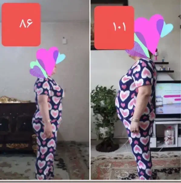 لاغری|آرایشی، بهداشتی، درمانی|ارومیه, |دیوار