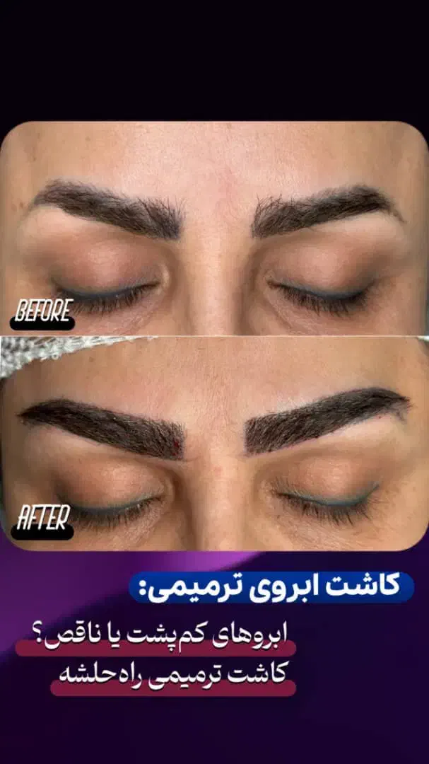 کاشت ابرو|خدمات آرایشگری و زیبایی|اندیشه, اندیشه فاز ۱|دیوار