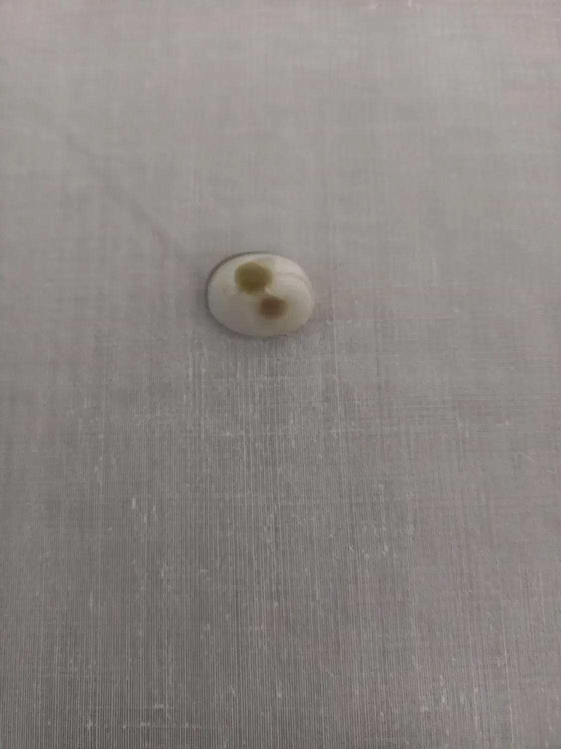 نگین انگشتر|کلکسیون اشیاء عتیقه|پردیس, فاز ۳|دیوار