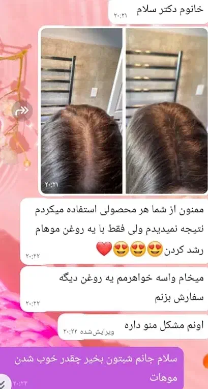 روغن تراپی|آرایشی، بهداشتی، درمانی|اهواز, عامری|دیوار