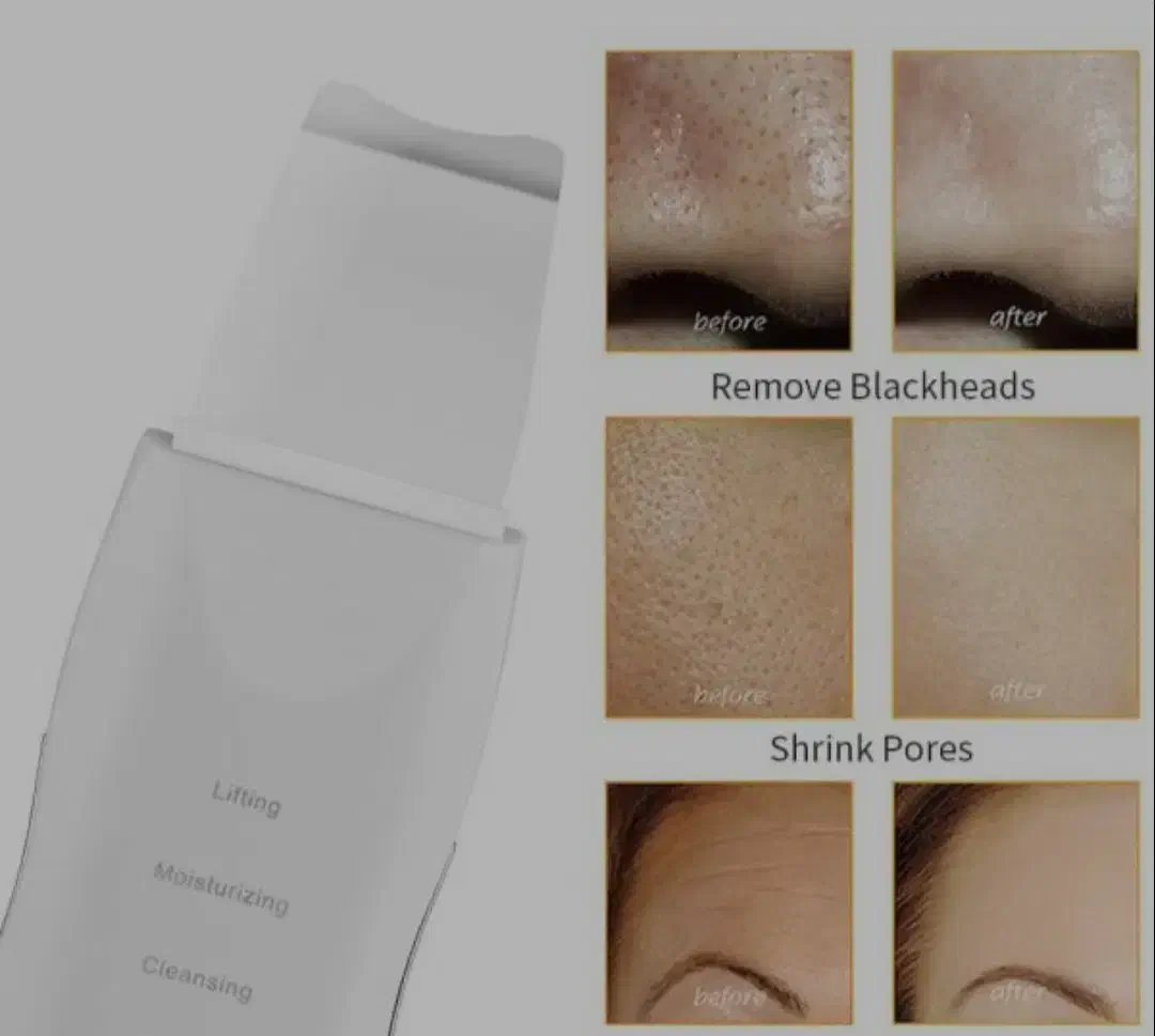 اتو صورت(درما اف)|آرایشی، بهداشتی، درمانی|زابل, |دیوار